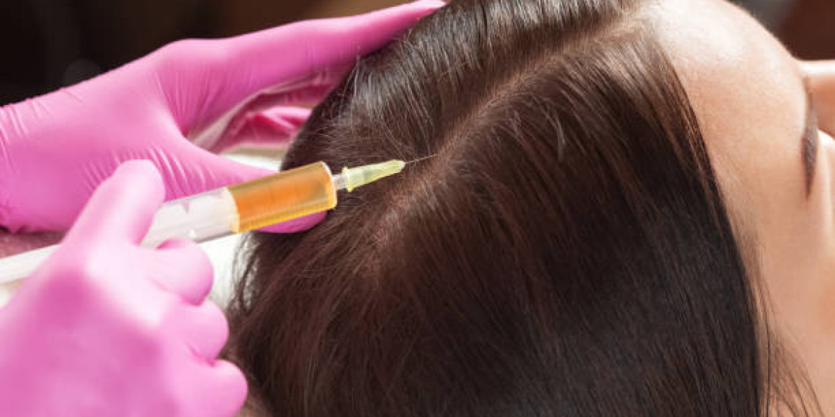 Understanding the Process of PRP Hair Regeneration