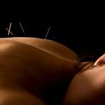 Grand Madison Acupuncture