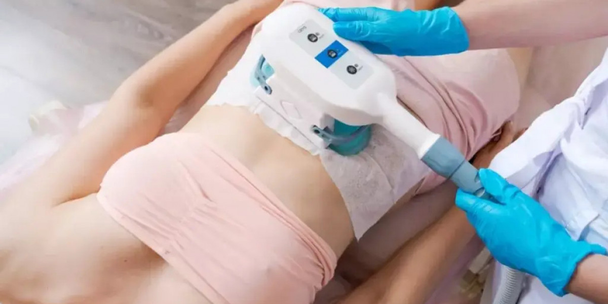 Liposonix Treatment Recovery: Do You Need Downtime?