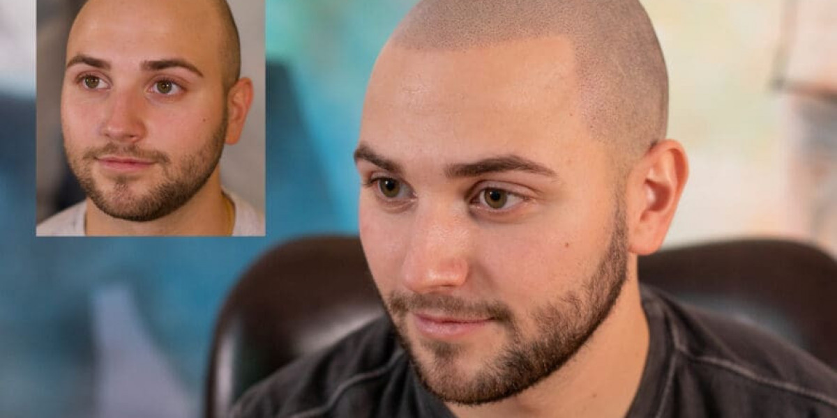 How to Maintain Your SMP Look for Years to Come