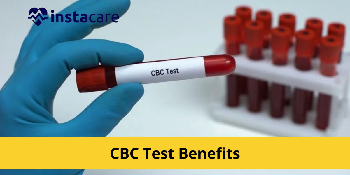 CBC Test Side Effects: Is It Safe?
